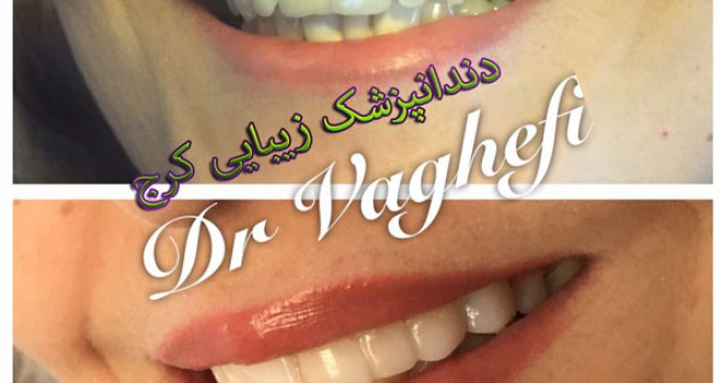 دندانپزشک زیبایی کرج (دکتر واقفی)